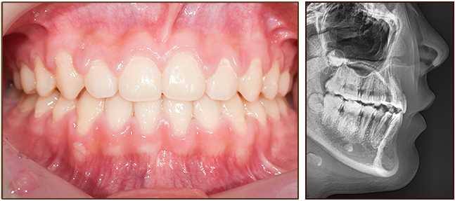 교정 후 이미지