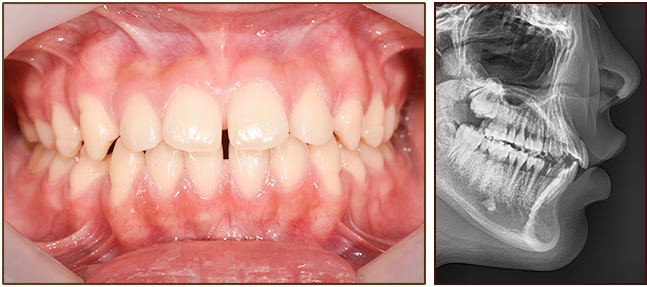 교정 전 이미지